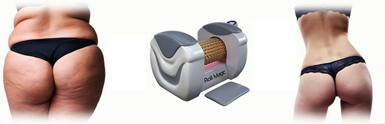 Próbáld ki a Magic Roll narancsbőr eltávolító kezelést 10 alkalmas bérlettel, kedvezményes DD kuponunkkal, a 17. kerületi Siluett Beauty Salonban!